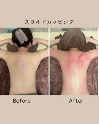 小顔モニター 募集のエステ・リラクイメージ