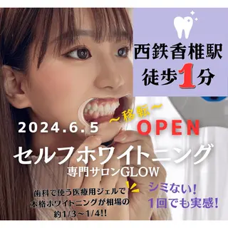 歯のセルフホワイトニング専門店GLOW（グロウ）所属・東区香椎歯のセルフホ ワイトニングGLOWのその他イメージ