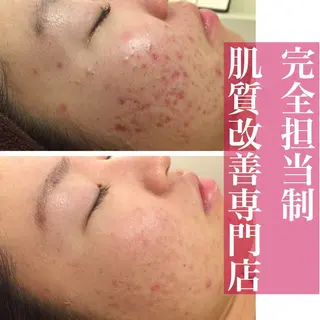 ミディアム カラー パーマ ヘアアレンジ メンズ キッズ ネイル マツエク・マツパ ニキビ・肌質改善専門 ♡人生が変わるサロンのエステ・リラクイメージ