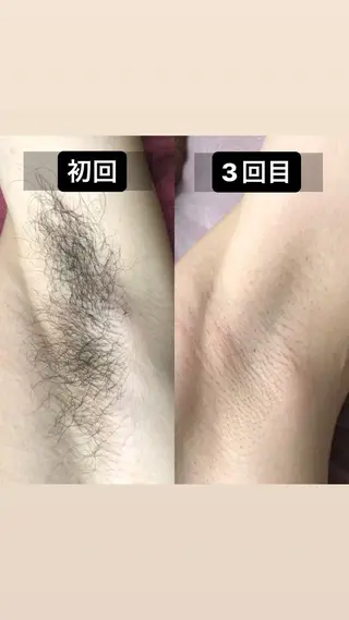 メンズ メンズ脱毛サロン kurozukinのエステ・リラクイメージ