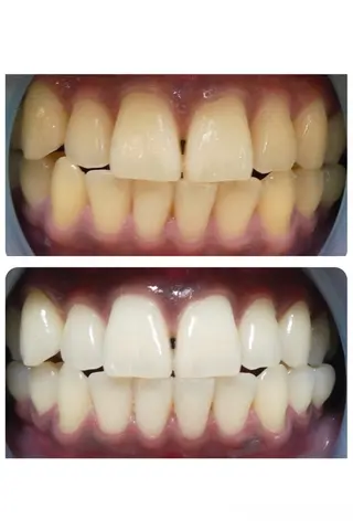 HAKU Aのその他イメージ