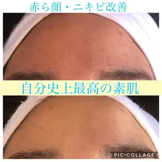 ショート カラー パーマ ヘアアレンジ キッズ ネイル マツエク・マツパ Ensor Clair所属・EnsorClair 代表　野口真央のエステ・リラクイメージ