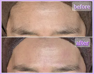 facial salon Lily所属・salon Lilyのエステ・リラクイメージ