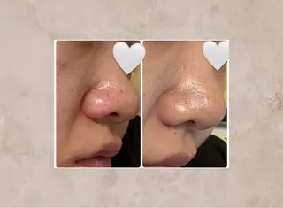 Total Beauty Salon Vi's CLUB by BINEL所属・Vi's CLUB KOTONOのエステ・リラクイメージ