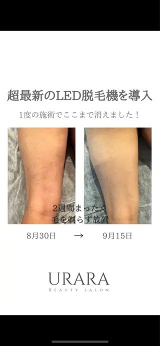 脱毛サロンpremium所属・ラヴィアンローズ 田町のエステ・リラクイメージ