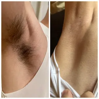 muscle＆esthe jonny's beauty所属・jonny's beautyのエステ・リラクイメージ