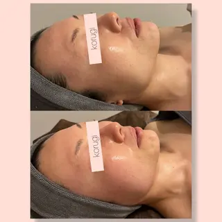 ☆痩身/小顔☆ ハイパーナイフexのエステ・リラクイメージ