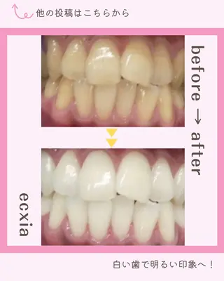 ホワイトニング/脱毛 専門店エクシア岡崎店のその他イメージ