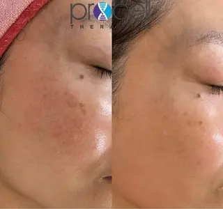 Blooming所属・LOUISE. ／肌質・頭皮のエステ・リラクイメージ