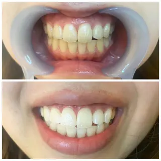 お手軽ホワイトニングsalon mina所属・武元 奈津美のその他イメージ