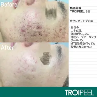 salonCOCO所属・肌管理看護師💎 salonCOCOのエステ・リラクイメージ