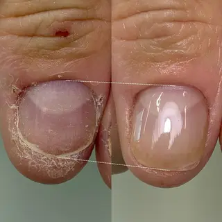 ネイル 広島市南区(広島県) /シンプル/自爪育成のネイルデザイン