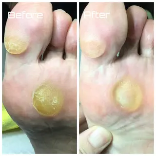 メンズ ネイル ドクターネイル爪革命 takahashiのその他イメージ