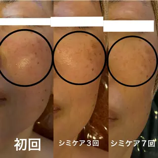 エステサロン グラマラスのエステ・リラクイメージ