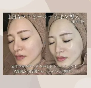 MLABO 新宿御苑のエステ・リラクイメージ