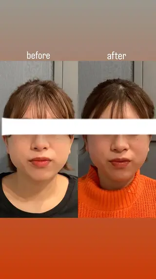 エステサロンino.colore'所属・小顔サロン ino.coloreのエステ・リラクイメージ