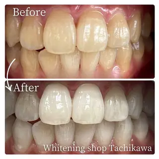 セルフ ホワイト ニングショップ立川のその他イメージ