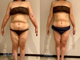 Esthetic MiEUXのエステ・リラクイメージ