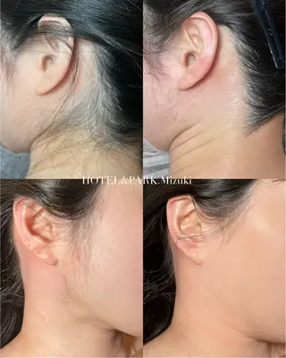 HOTEL&PARK . ワックス脱毛のエステ・リラクイメージ