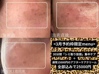 サロンマミ MAMIのエステ・リラクイメージ