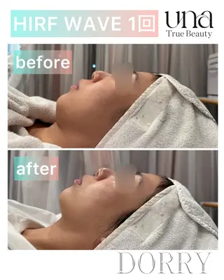 UNA SHIROKANE所属・脂肪冷却サロンUNA SHIROKANEのその他イメージ