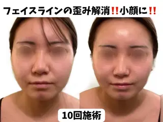 サロンハート浦和店所属・痩身小顔サロンハート 浦和店のエステ・リラクイメージ