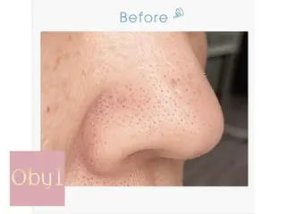 肌管理/ピーリング オーバイワン恵比寿のエステ・リラクイメージ