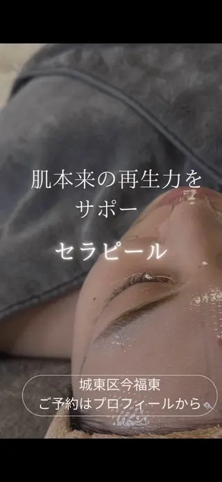 肌管理フェイシャル｜Utouto所属・肌管理フェイシャル Utoutoのエステ・リラクイメージ