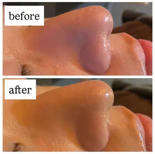 肌質改善専門 ハーブ /毛穴洗浄 リエイトのエステ・リラクイメージ