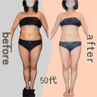 痩身エステ Julien麹町店のエステ・リラクイメージ