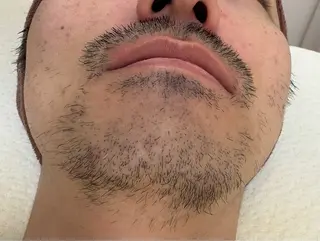 ルナ カーザのエステ・リラクイメージ