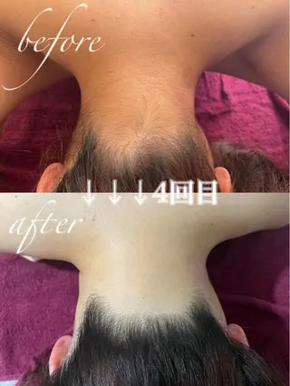 Reine BeautySalon所属・毛穴/シミ肝斑/脱毛 横山梨里のエステ・リラクイメージ