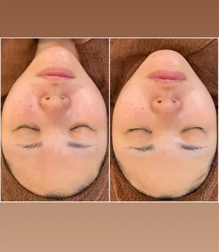 パーソナル肌質改善 🦋APRI🅿️有のエステ・リラクイメージ