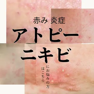 シミ毛穴|眉Wax THE  flowのエステ・リラクイメージ