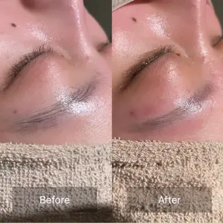 アイブロウ for woman所属・森 美優のエステ・リラクイメージ