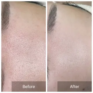 ガレリア　エステ　名駅所属・シオダ チコトのエステ・リラクイメージ