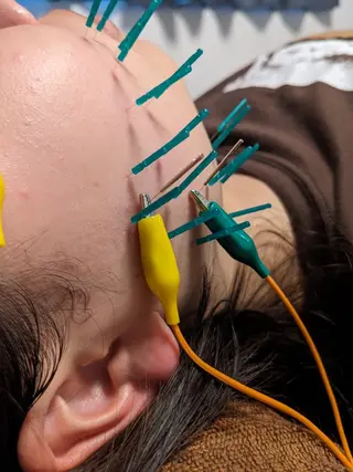 乃々鍼灸・整体院　表参道所属・乃々鍼灸整体院　植木 　【美容鍼/整体】のエステ・リラクイメージ