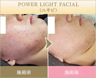 ˚⟡ suwan .˚⟡のエステ・リラクイメージ