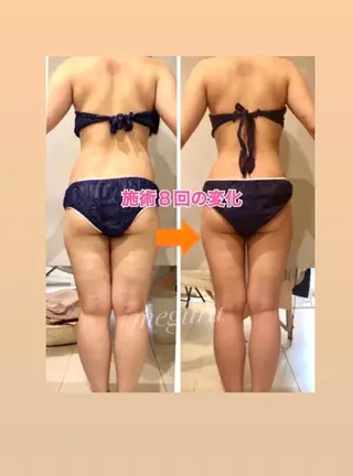 ショート カラー パーマ ヘアアレンジ メンズ キッズ ネイル マツエク・マツパ ‍痩身＆ボディ 結果出し🌟丹野のエステ・リラクイメージ