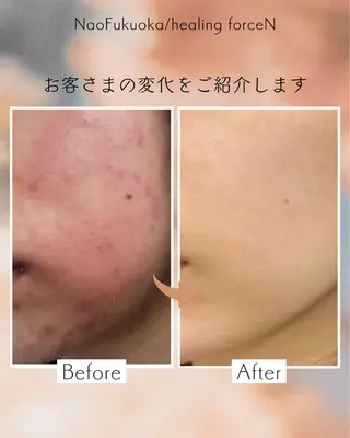 Nao Fukuoka/healingforceN所属・野中 康子のエステ・リラクイメージ