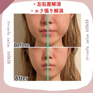 中目黒  整体 小顔 KUOKOAのエステ・リラクイメージ