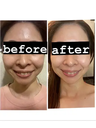 脱毛・エステサロン LuLuNのエステ・リラクイメージ