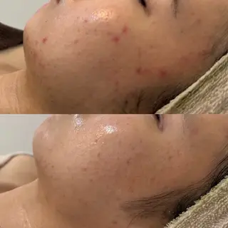 Nicore所属・肌質改善🌿まつ毛 chapiのその他イメージ