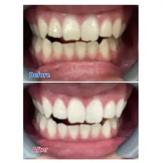 M渋谷店所属・M渋谷 ホワイトニングのエステ・リラクイメージ