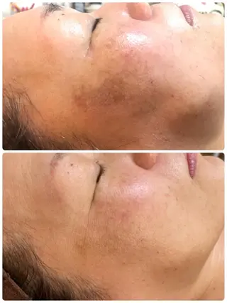 サロンドプララン所属・サロンド プラランのエステ・リラクイメージ