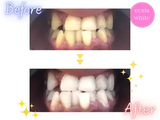 セルフホワイトニング エクシア鶴岡店のその他イメージ