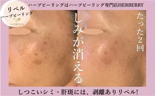 ハーブピーリング専門店HERBERRY難波心斎橋店所属・ハーブピーリング専門 HERBERRY冨永のエステ・リラクイメージ