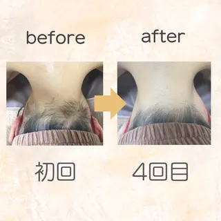 脱毛専門店 Angemのエステ・リラクイメージ