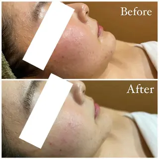 ハーブピーリング専門 muro.のエステ・リラクイメージ