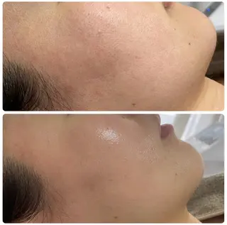 Esthe salon Blanche(エステサロンブランシュ)所属・小顔リフトアップ 美肌改善専門店のエステ・リラクイメージ